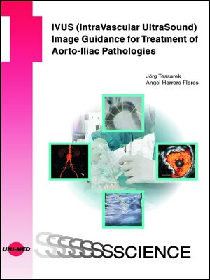 cover image of IVUS Image Guidance for Treatment of Aorto-Iliac Pathologies